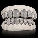 Iced VVS Moissanite Grillz (Straight Setting)