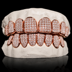 Iced VVS Moissanite Grillz (Straight Setting)