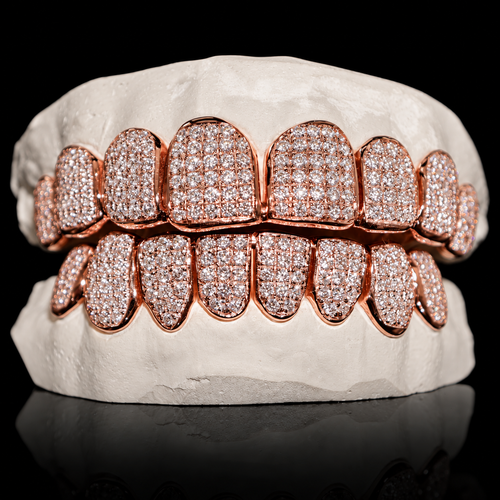Iced VVS Moissanite Grillz (Straight Setting)