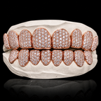 Iced VVS Moissanite Grillz (Zig Zag Setting)