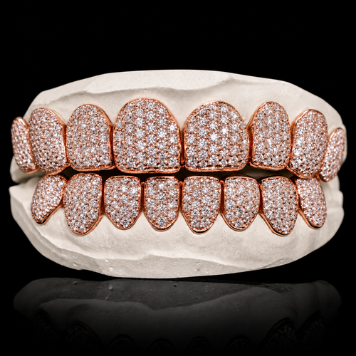 Iced VVS Moissanite Grillz (Zig Zag Setting)