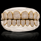 Iced VVS Moissanite Grillz (Zig Zag Setting)