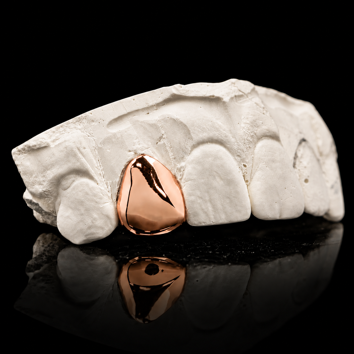Solid Gold Single Tooth Grillz