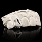 Solid Gold Single Tooth Grillz